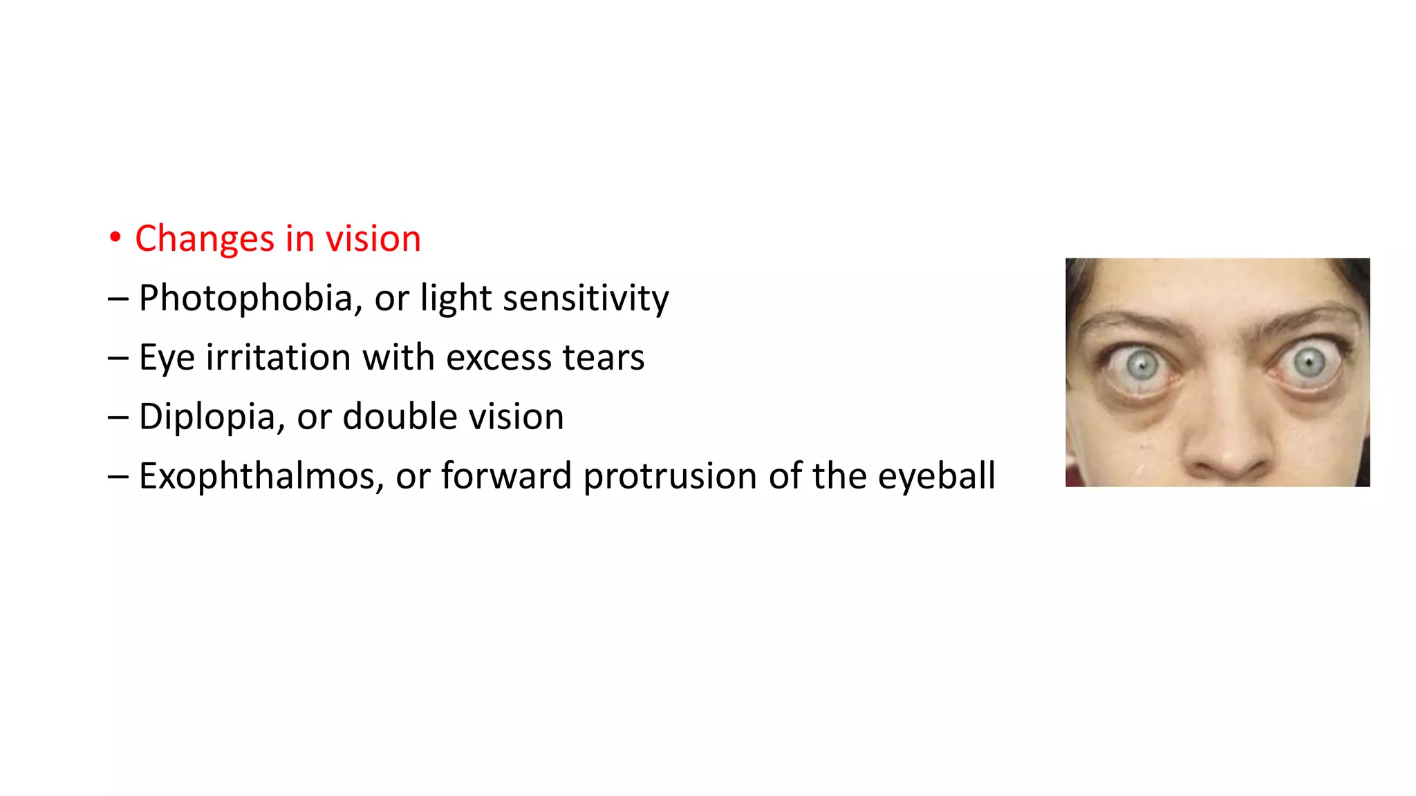 • Changes in vision
– Photophobia, or light sensitivity
– Eye irritation with excess tears
– Diplopia, or double vision
– Exophthalmos, or forward protrusion of the eyeball
 