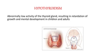 HYPOTHYROIDISM
Abnormally low activity of the thyroid gland, resulting in retardation of
growth and mental development in children and adults
 