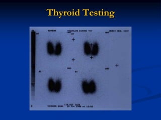 Hyperthyroidism Testing Hyperthyroidism the lect .ppt