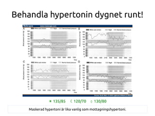 Behandla hypertonin dygnet runt!
☀ 135/85 120/70☾ ⌚ 130/80
Maskerad hypertoni är lika vanlig som mottagningshypertoni.
 