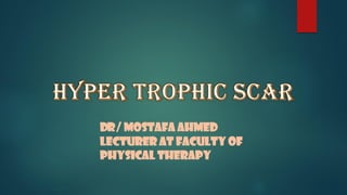 DR/ MOSTAFA AHMED
LECTURER AT FACULTY OF
PHYSICAL THERAPY
 