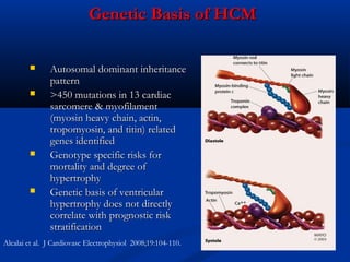 Hcm Variations Hypertrophic cardiomyopathy | PPT