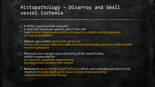 Histopathology – Disarray and Small
vessel ischemia
▪ In HCM, hypertrophied myocytes
in both the ventricular septum and LV free wall
have bizarre shapes and are often arranged in a chaotic and disorganized
architectural pattern
▪ Patients also exhibit structurally abnormal
intramural coronary arterioles with thickened vessel walls caused by media smooth
muscle hyperplasia
▪ Microvascular changes cause narrowing of the vessel lumen,
which is responsible for
an impaired vasodilator response and
blunting of the coronary flow reserve
▪ Believed to cause “small-vessel” ischemia, which, over extended periods of time,
results in myocyte death and a repair process characterized by
replacement myocardial fibrosis
 