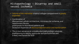 Histopathology – Disarray and small
vessel ischemia
▪ Volume of the interstitial (matrix) collagen compartment is greatly
expanded
▪ Combination of
disorganized cellular architecture, microvascular ischemia, and
replacement fibrosis
predisposes to disordered patterns and
increased dispersion of electrical depolarization and repolarization
▪ This in turn serves as an unstable electrophysiologic substrate
predisposing to reentry ventricular tachyarrhythmias and
a likely mechanism for SCD
 