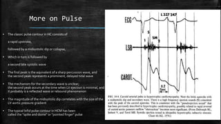 More on Pulse
▪ The classic pulse contour in HC consists of
a rapid upstroke,
followed by a midsystolic dip or collapse,
▪ Which in turn is followed by
a second late systolic wave
▪ The first peak is the equivalent of a sharp percussion wave, and
the second peak represents a prominent, delayed tidal wave
▪ The mechanism for the secondary wave is unclear;
the second peak occurs at the time when LV ejection is minimal, and
it probably is a reflected wave or rebound phenomenon
▪ The magnitude of the midsystolic dip correlates with the size of the
LV-aortic pressure gradient
▪ The typical bifid pulse contour in HCM has been
called the "spike and dome" or "pointed finger" pulse
 