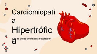 Cardiomiopatí
a
Hipertrófic
a
 