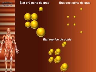 État pré perte de gras       État post perte de gras




                 État reprise de poids
 