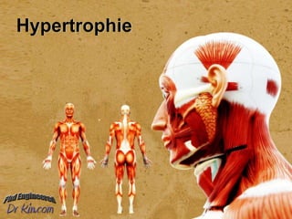 Hypertrophie
 