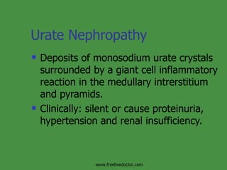 Urate Nephropathy Deposits of monosodium urate crystals surrounded by a giant cell inflammatory reaction in the medullary intrerstitium and pyramids. Clinically: silent or cause proteinuria, hypertension and renal insufficiency.  www.freelivedoctor.com 
