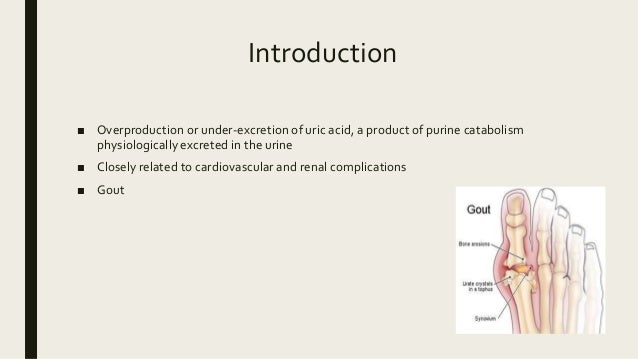 Hyperuricemia ; Focus on Treatment