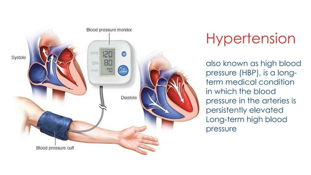 Dental Management of Hypertention | PDF | Heart and Cardiovascular ...