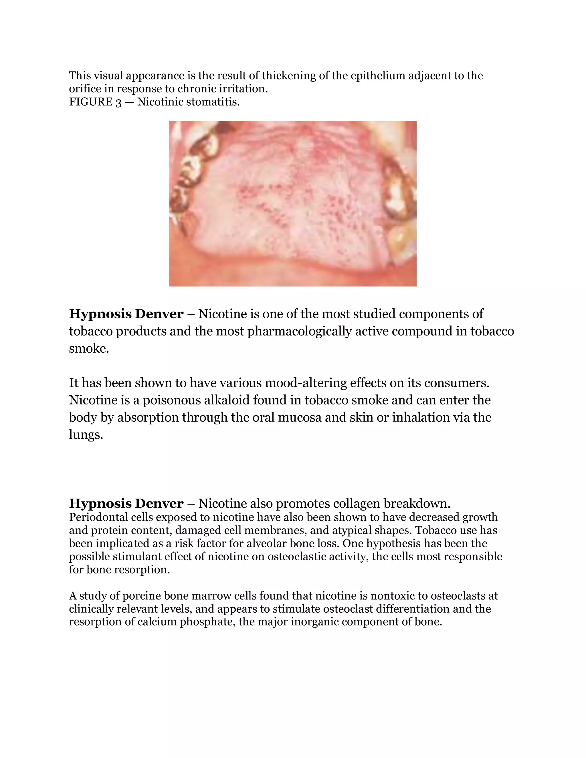 Hypnosis denver does smoking affect periodontal disease PDF