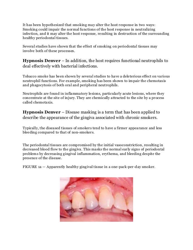 Hypnosis denver – does smoking affect periodontal disease