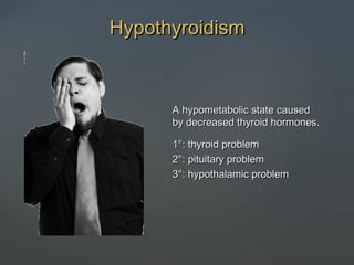 A hypometabolic state causedA hypometabolic state caused
by decreased thyroid hormones.by decreased thyroid hormones.
1°: thyroid problem1°: thyroid problem
2°: pituitary problem2°: pituitary problem
3°: hypothalamic problem3°: hypothalamic problem
HypothyroidismHypothyroidism
 