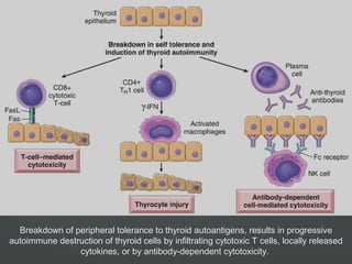Breakdown of peripheral tolerance to thyroid autoantigens, results in progressive
autoimmune destruction of thyroid cells by infiltrating cytotoxic T cells, locally released
cytokines, or by antibody-dependent cytotoxicity.
 