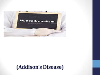 (Addison’s Disease)
 