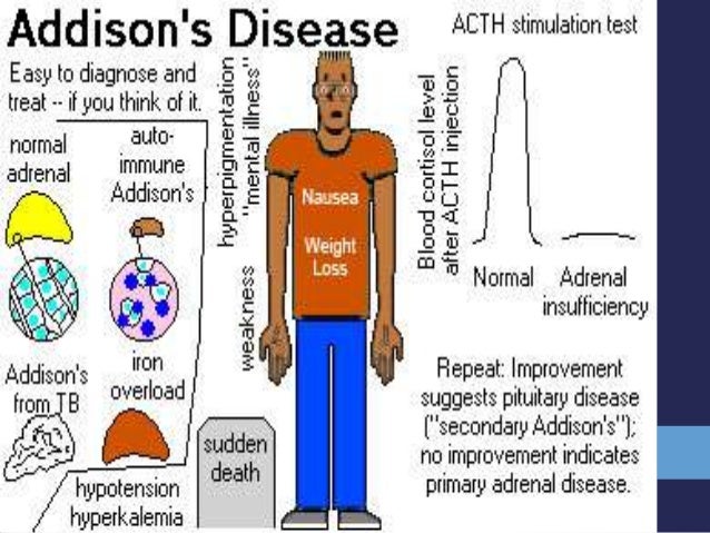 Hypoadrinalism