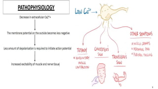 HYPOCALCEMIA for residents and medical students | PDF