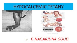 HYPOCALCEMIC TETANY
by G.NAGARJUNA GOUD
 