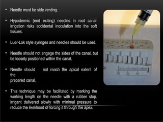 Apical Inoculation hypo chlorite in endodontics and conservative dentistry | PPTX