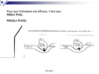 JPP IADE 1
Pour que l’hématose soit efficace, il faut que :
PAO2> PvO2
PACO2< PvCO2
 