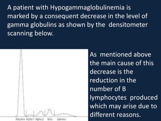 A patient with Hypogammaglobulinemia is
marked by a consequent decrease in the level of
gamma globulins as shown by the densitometer
scanning below.
As mentioned above
the main cause of this
decrease is the
reduction in the
number of B
lymphocytes produced
which may arise due to
different reasons.
 
