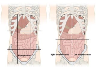 Hypogastrium Right lower quadrant Left lower quadrant
 