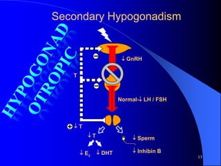 Secondary Hypogonadism


                         GnRH


   T



                       Normal- LH / FSH



   T
          T                 Sperm

        E2     DHT         Inhibin B
                                           13
 