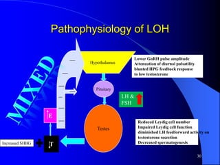 Pathophysiology of LOH

                                          Lower GnRH pulse amplitude
                        Hypothalamus      Attenuation of diurnal pulsatility
                                          blunted HPG feedback response
                                          to low testosterone


                          Pituitary
                                       LH &
                                       FSH

                 E
                                              Reduced Leydig cell number
                           Testes             Impaired Leydig cell function
                                              diminished LH feedforward activity on
                                              testosterone secretion
Increased SHBG                                Decreased spermatogenesis
                 T
                                                                               30
 