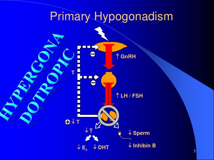 Male Hypogonadism, LOH,