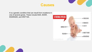 hypohidrotic ectodermal dysplasia.pptx