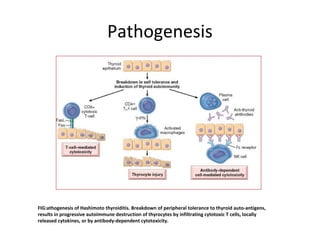 Pathogenesis Hyperthyroid Hypo hyper thyroid graves | PPT