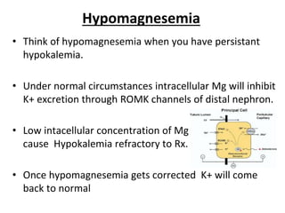Hypomagnesemia
• Think of hypomagnesemia when you have persistant
hypokalemia.
• Under normal circumstances intracellular Mg will inhibit
K+ excretion through ROMK channels of distal nephron.
• Low intacellular concentration of Mg
cause Hypokalemia refractory to Rx.
• Once hypomagnesemia gets corrected K+ will come
back to normal
 