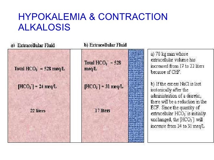 CME Hypokalemia