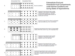 Extracellular-Fluid and
Intracellular-Fluid Compartments
under Normal Conditions and
during States of Hyponatremia.
 