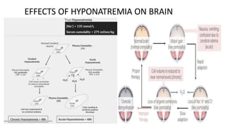 EFFECTS OF HYPONATREMIA ON BRAIN
 