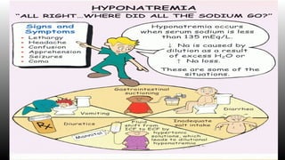 Hyponatremia by akram