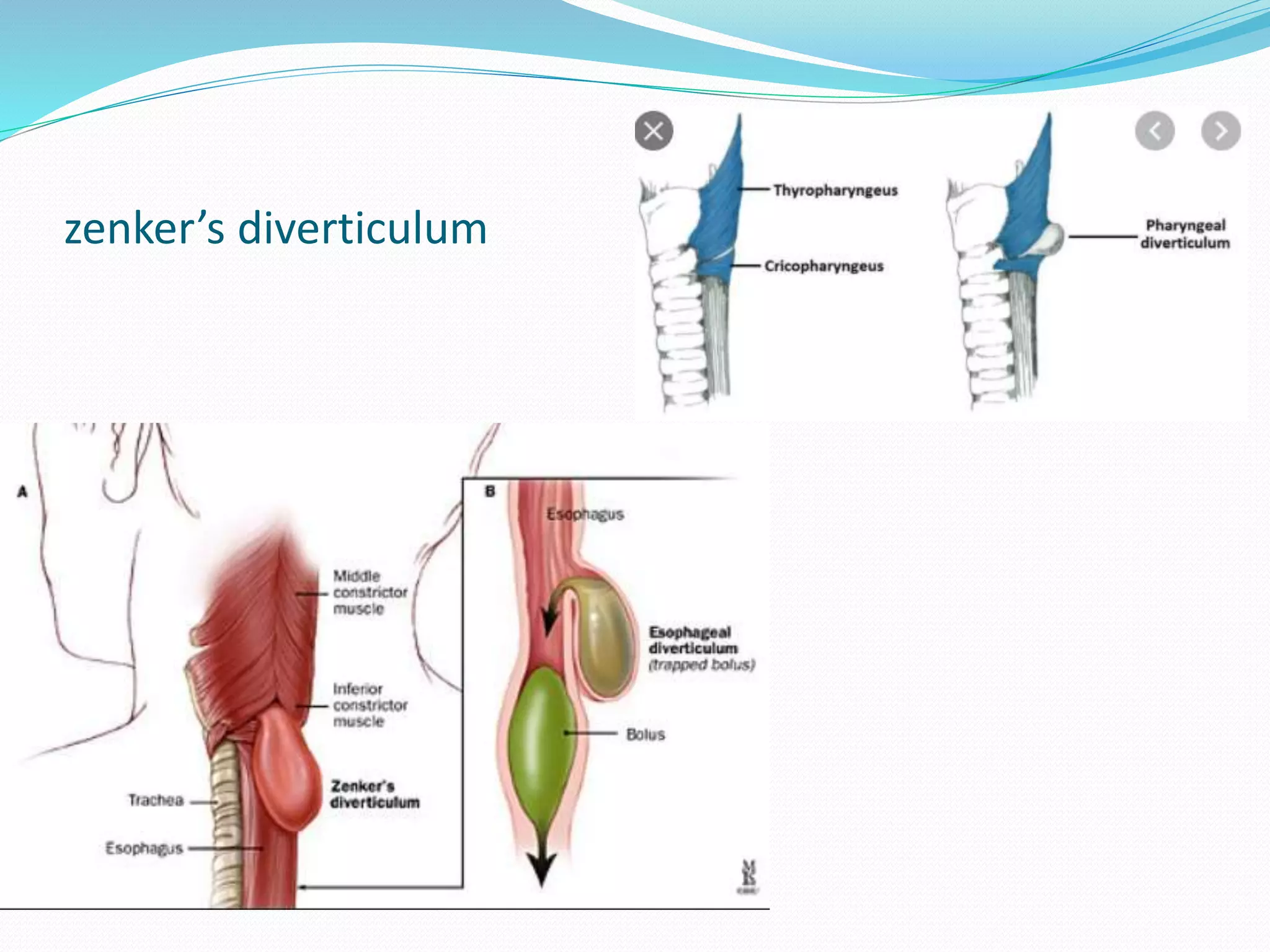 Hypopharynx Anatomy PPTX hypopharynx-anatomy-pptx