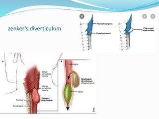 Hypopharynx anatomy
