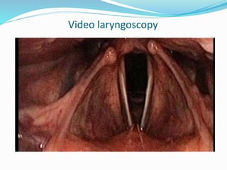 Hypopharynx anatomy