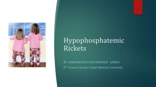 Hypophosphatemic
Rickets
BY: AGBONKHESE EGHONGHON SARAH
6TH Course Grodno State Medical University
 