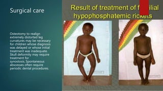 Surgical care
Osteotomy to realign
extremely distorted leg
curvatures may be necessary
for children whose diagnosis
was delayed or whose initial
treatment was inadequate.
Skull deformity may require
treatment for
synostosis. Spontaneous
abscesses often require
periodic dental procedures.
 
