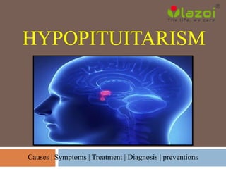 HYPOPITUITARISM
Causes | Symptoms | Treatment | Diagnosis | preventions
 