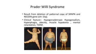 Hypopituitarism