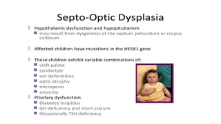 Hypopituitarism