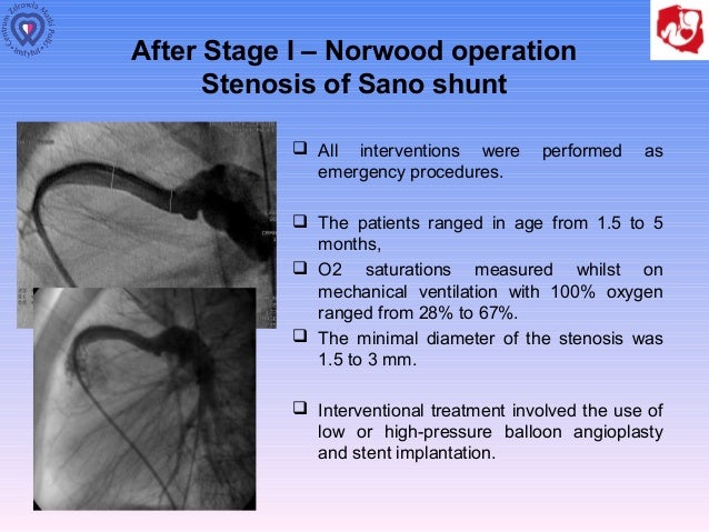 pressure test procedure syndome left heart Hypoplastic  Tomasz prof. Moszura