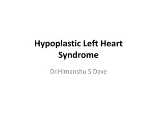 Hypoplastic Left Heart
Syndrome
Dr.Himanshu S Dave
 