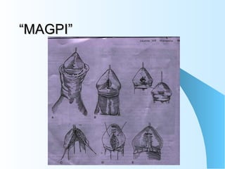 “MAGPI” 