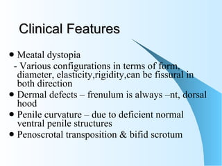 Clinical Features Meatal dystopia  - Various configurations in terms of form, diameter, elasticity,rigidity,can be fissural in both direction  Dermal defects – frenulum is always –nt, dorsal hood Penile curvature – due to deficient normal ventral penile structures  Penoscrotal transposition & bifid scrotum 