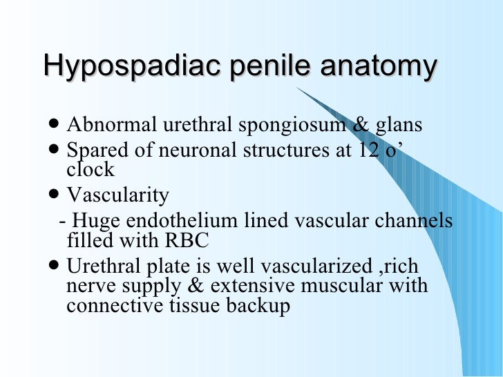 Hypospadias